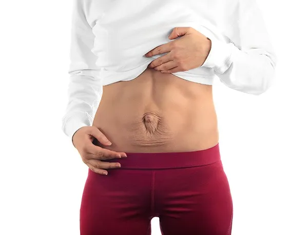 rs.diastasis-recti