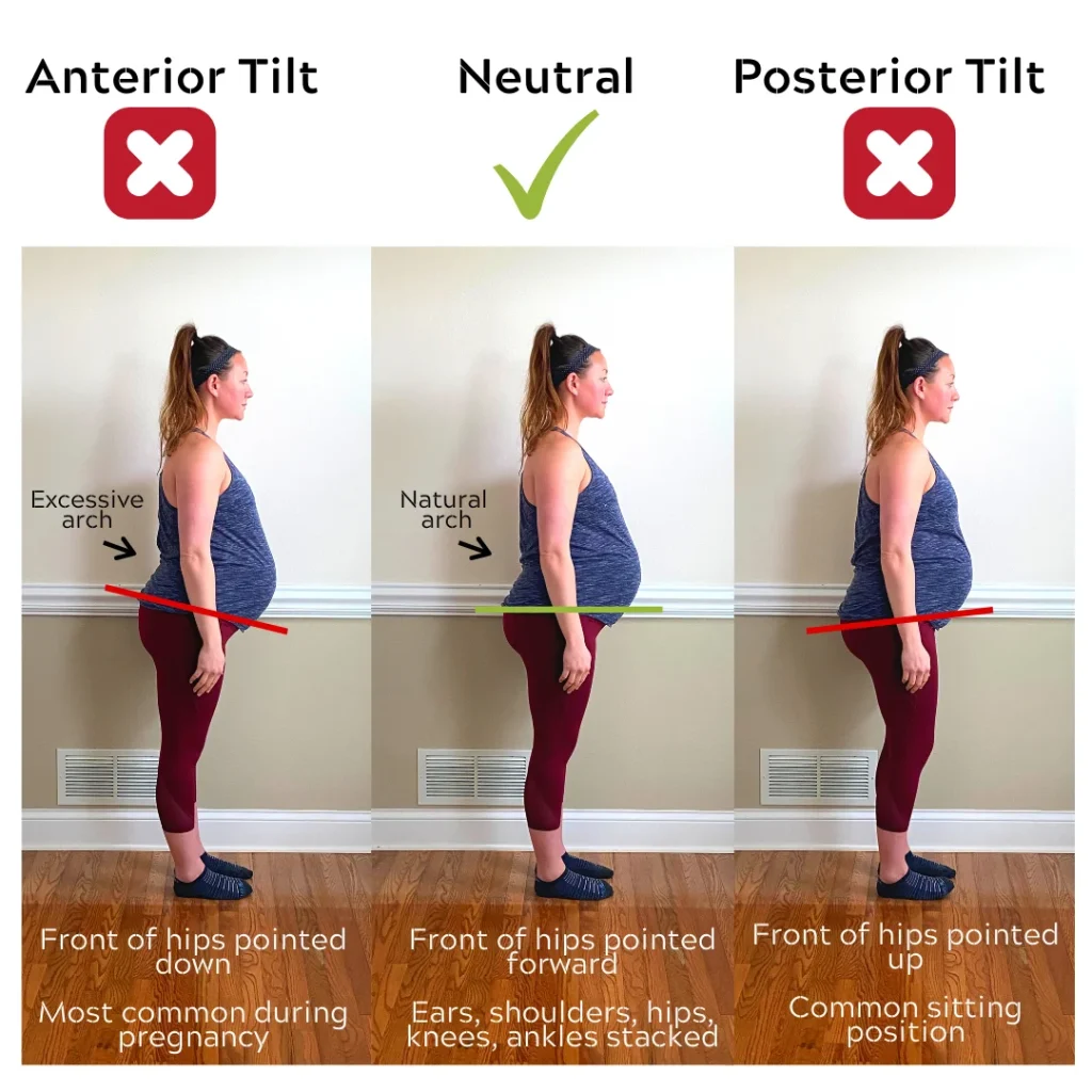 comparing anterior and neutral posture in pregnancy