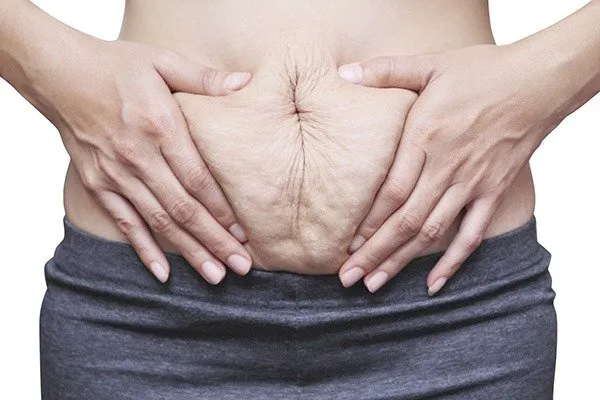 How to Choose the Best Diastasis Recti Program?
