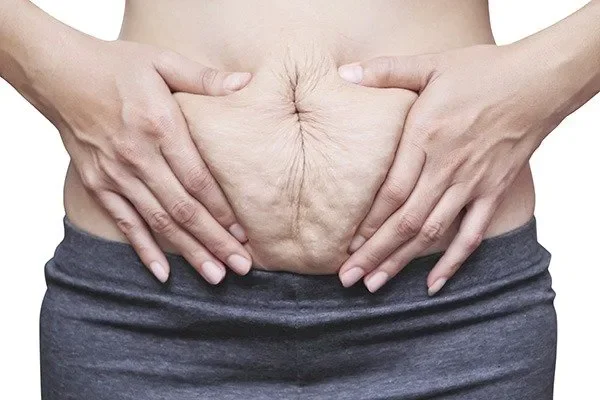 How to Choose the Best Diastasis Recti Program?