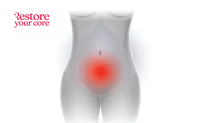 What Does Pelvic Floor Pain Feel Like?