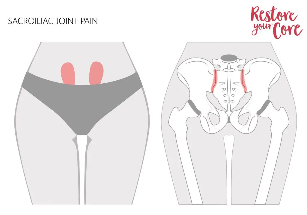 sacroiliac joint pain