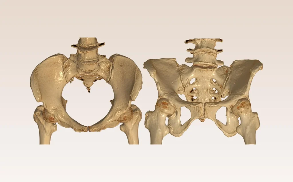 Coccyx Pain