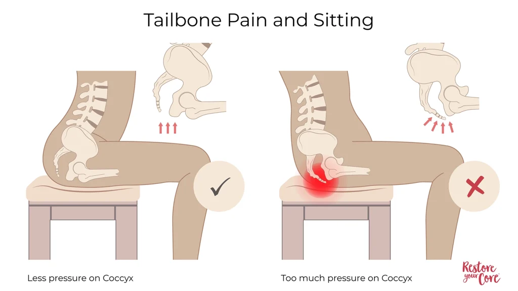 Tailbone Pain and Sitting