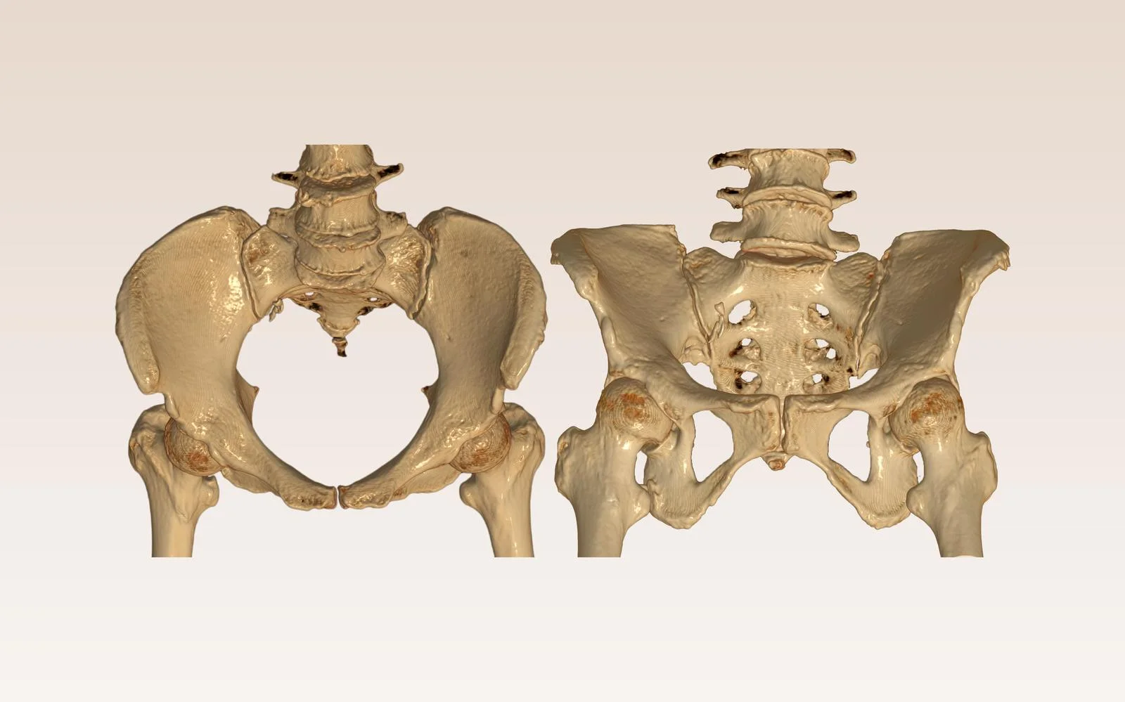 Navigating Coccyx Pain in Pregnancy: A Trimester-by-Trimester Guide