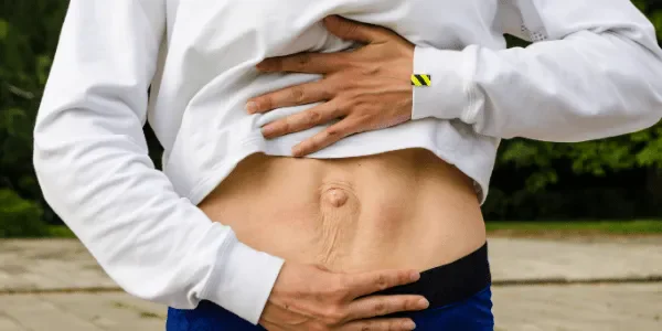 Can You Have a Flat Stomach with Diastasis Recti?